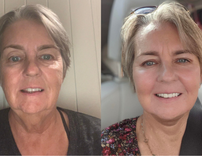 Get Rid of wrinkles,Look younger in 30 days with our Anti-aging solution