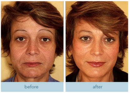 Get Rid of wrinkles,Look younger in 30 days with our Anti-aging solution
