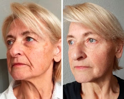 Get Rid of wrinkles,Look younger in 30 days with our Anti-aging solution