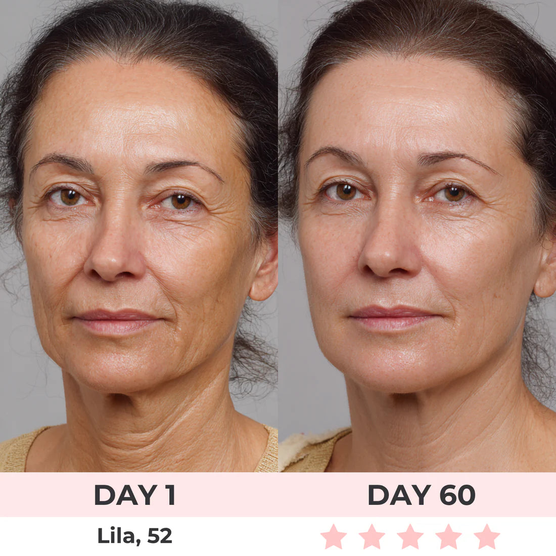Get Rid of wrinkles,Look younger in 30 days with our Anti-aging solution