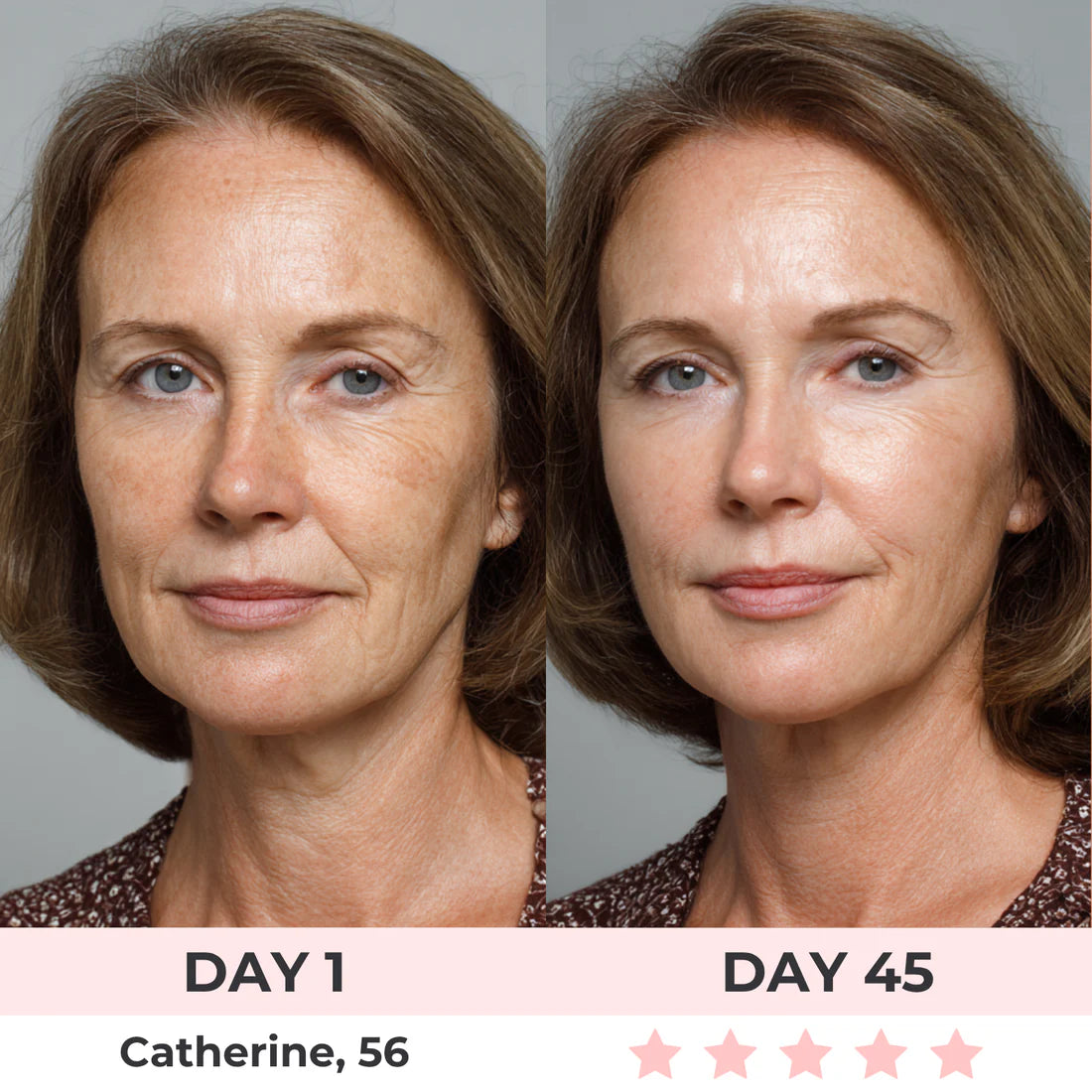 Get Rid of wrinkles,Look younger in 30 days with our Anti-aging solution