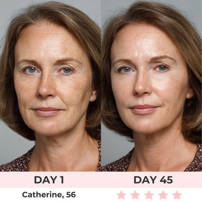 Get Rid of wrinkles,Look younger in 30 days with our Anti-aging solution