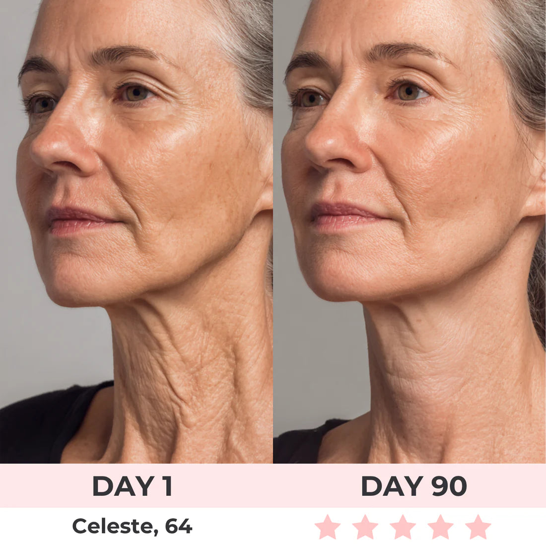 Get Rid of wrinkles,Look younger in 30 days with our Anti-aging solution