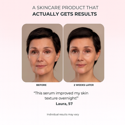 Get Rid of wrinkles,Look younger in 30 days with our Anti-aging solution