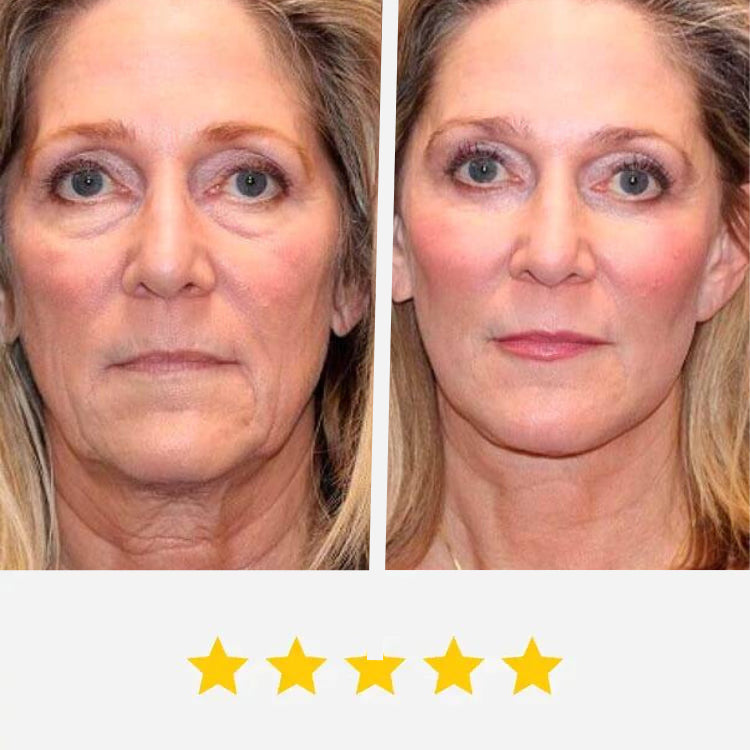 Get Rid of wrinkles,Look younger in 30 days with our Anti-aging solution