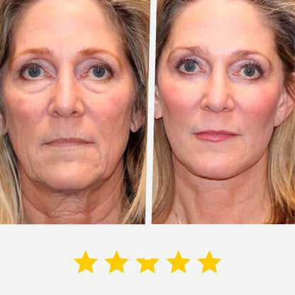 Get Rid of wrinkles,Look younger in 30 days with our Anti-aging solution