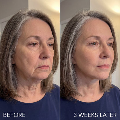 Get Rid of wrinkles,Look younger in 30 days with our Anti-aging solution