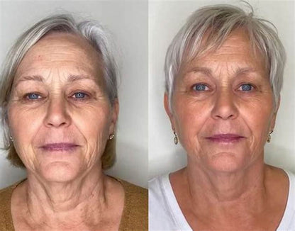 Get Rid of wrinkles,Look younger in 30 days with our Anti-aging solution