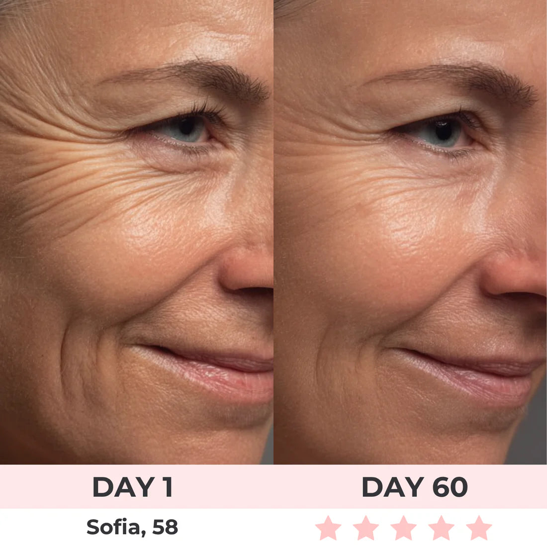 Get Rid of wrinkles,Look younger in 30 days with our Anti-aging solution