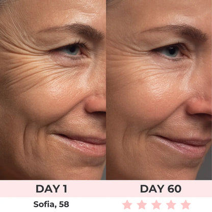 Get Rid of wrinkles,Look younger in 30 days with our Anti-aging solution